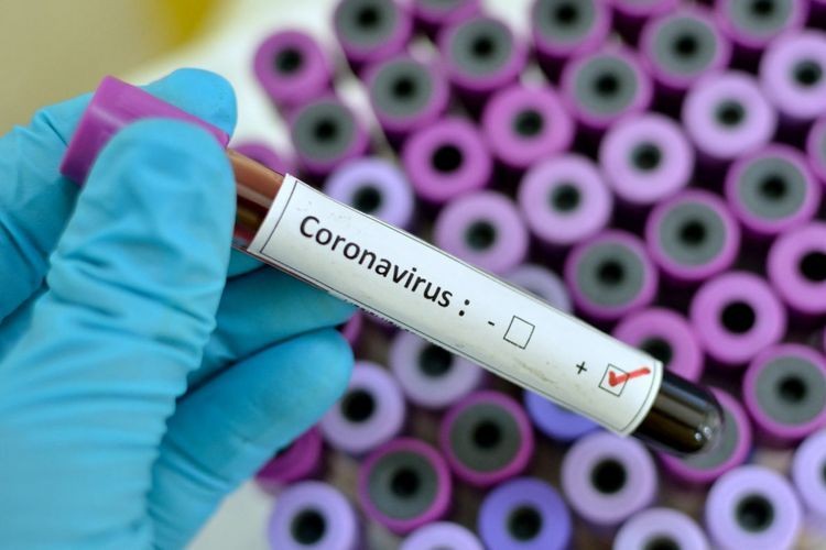 Koronavirusun ikinci dalğası yayılmağa başladı - SON DƏQİQƏ