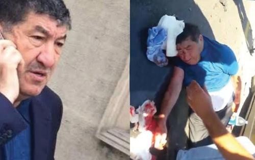 Hacı Mazanın vəziyyəti ağırlaşdı: Əməliyyat edə bilmirlər –