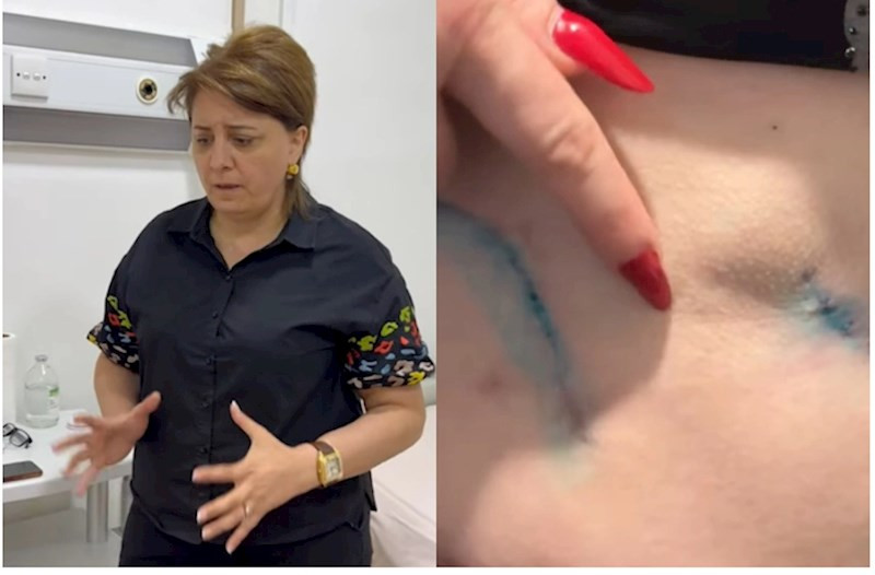 Prokurorluqda pasiyentin ölüm işində adı keçən həkim yenidən cərrahlıq edir?